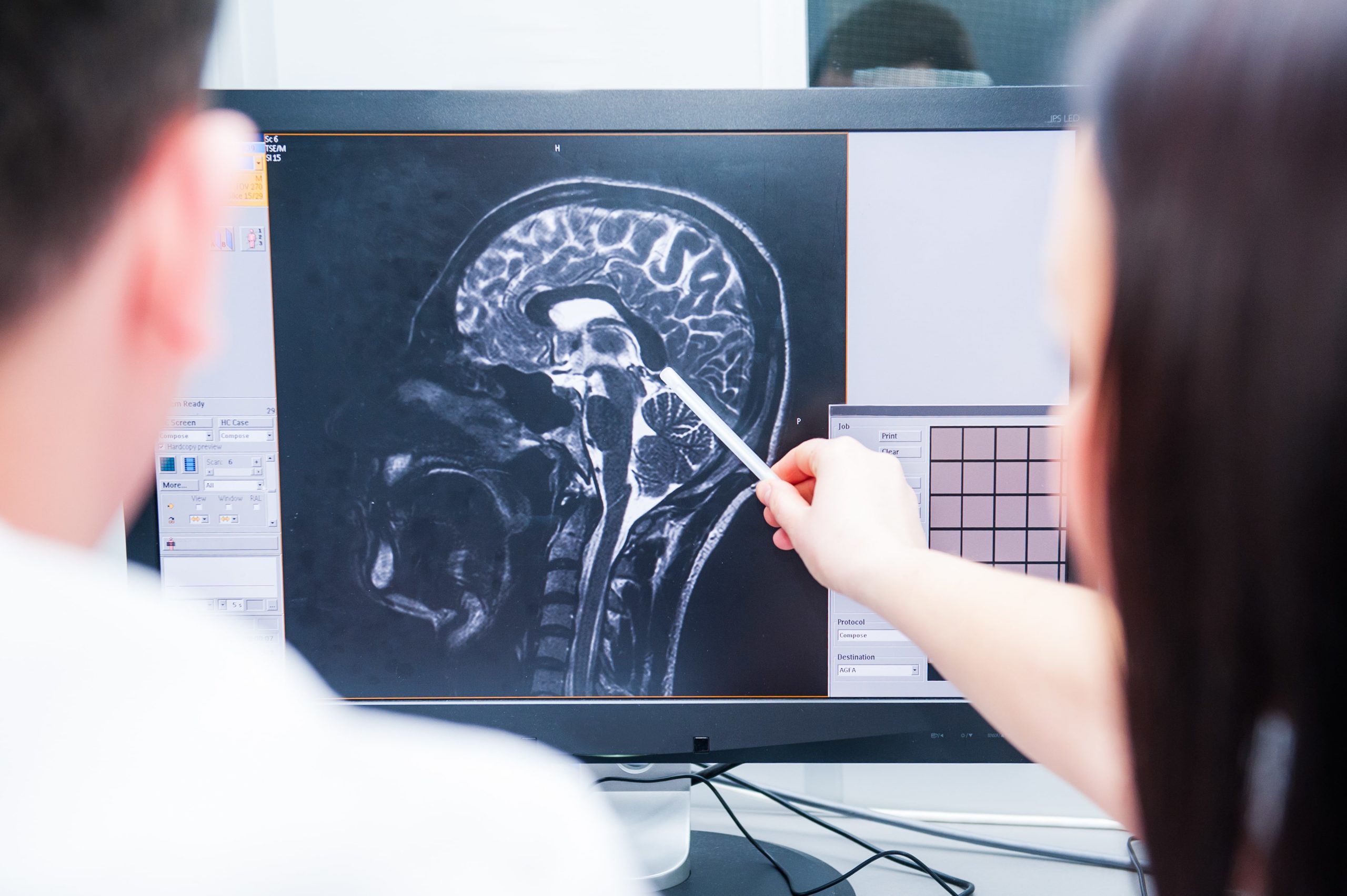 traumatic brain injury utah